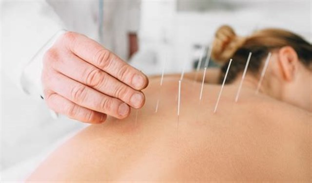 Acupuncture Services at Paragon Chiropractic